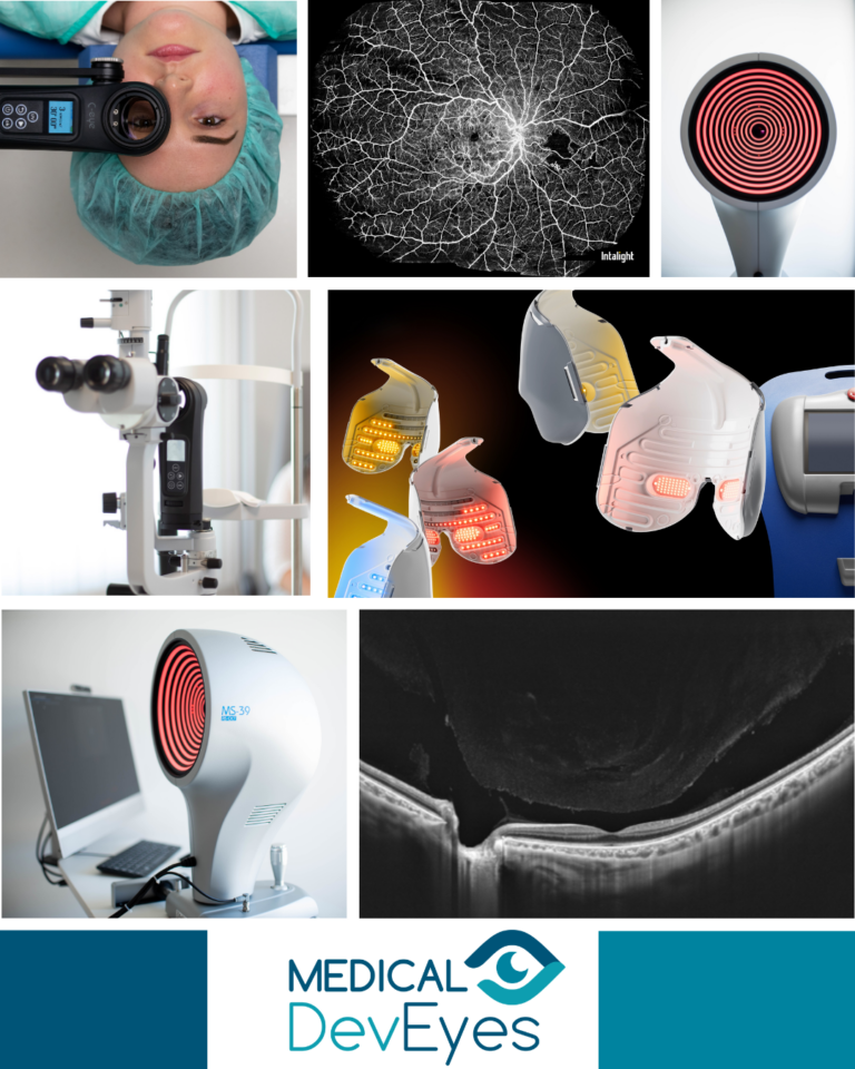 innovation ophtalmologie